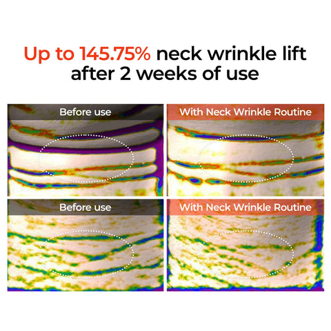 3-Minute Neck Wrinkle Care Trio